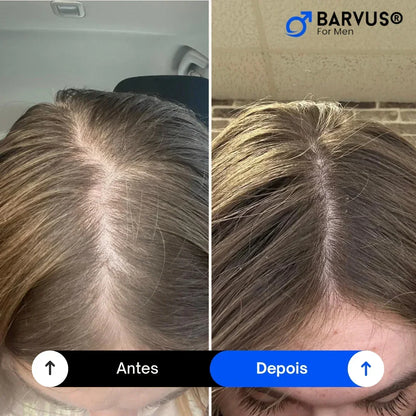 Minoxidil KIRKLAND® 5% - Original